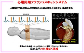 真：心電同期フラッシュスキャンシステム0184
